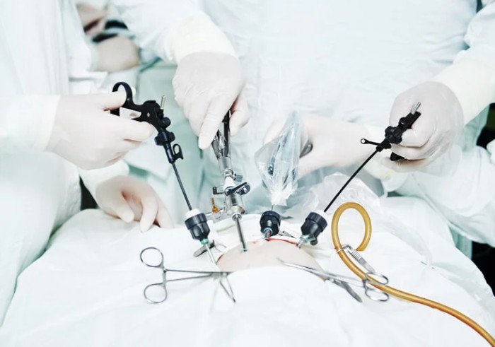 Why laparoscopic surgery is better than open surgery