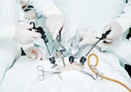 Why laparoscopic surgery is better than open surgery