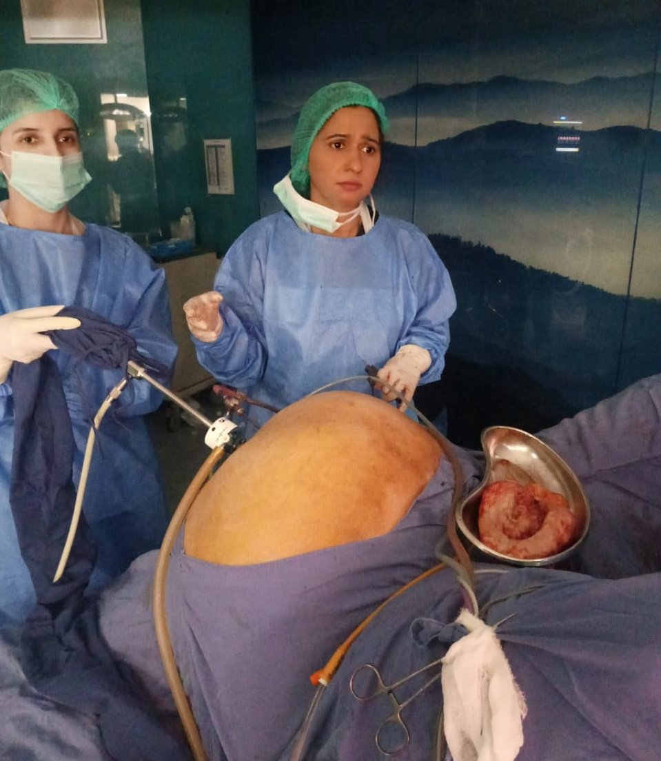 Benefits of Laparoscopic hysterectomy